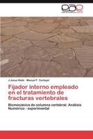Fijador interno empleado en el tratamiento de fracturas vertebrales: Biomecánica de columna vertebral: Análisis Numérico - experimental 384549252X Book Cover