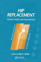 Hip Replacement: Current Trends and Controversies 0367446995 Book Cover
