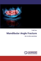 Mandibular Angle Fracture: An in vitro overview 6139471885 Book Cover