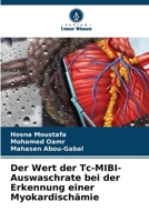 Der Wert der Tc-MIBI-Auswaschrate bei der Erkennung einer Myokardischämie (German Edition) 6206902994 Book Cover