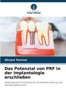 Das Potenzial von PRF in der Implantologie erschließen: Evidenzbasierte Protokolle für verbesserte Heilung und Geweberegeneration (German Edition) 6208817153 Book Cover