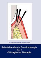 Arbeitshandbuch Parodontologie: Band 2 Chirurgische Therapie 3837046354 Book Cover