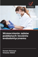 Wzmocnienie zębów poddanych leczeniu endodontycznemu 6206727629 Book Cover