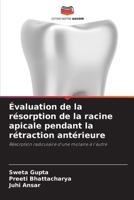 Évaluation de la résorption de la racine apicale pendant la rétraction antérieure (French Edition) 6134977896 Book Cover