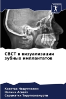 Cbct в визуализации зубных и&# 6205379422 Book Cover