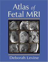 Atlas of Fetal MRI 0824725484 Book Cover