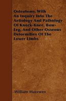 Osteotomy, with an Inquiry Into the Aetiology and Pathology of Knock-Knee, Bow-Leg, and Other Osseous Deformities of the Lower Limbs 1271771225 Book Cover