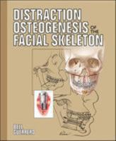 Distraction Osteogenesis of the Facial Skeleton 1550093444 Book Cover