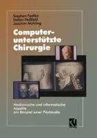 Computerunterstutzte Chirurgie: Medizinische Und Informatische Aspekte Am Beispiel Einer Pilotstudie 3663052389 Book Cover
