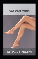 Varicose Veins: A Simple Guide About varicose veins And Its Natural Remedy! B084WPXC9C Book Cover