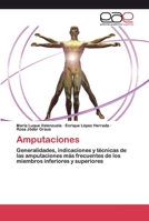 Amputaciones 6200395810 Book Cover
