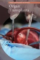 Organ Transplants 1502643790 Book Cover