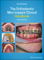The Orthodontic Mini-Implant Clinical Handbook 1119509750 Book Cover