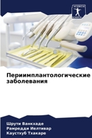 Периимплантологически 6205759780 Book Cover