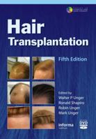 Hair transplantation 1616310065 Book Cover