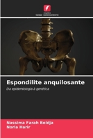 Espondilite anquilosante 6209590659 Book Cover