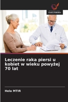Leczenie raka piersi u kobiet w wieku powyzej 70 lat (Polish Edition) 6208641519 Book Cover