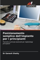 Posizionamento semplice dell'impianto per i principianti (Italian Edition) 6200712859 Book Cover