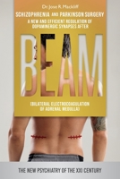 Schizophrenia and Parkinson Surgery : A New and Efficient Regulation of Dopaminergic Synapses after BEAM (Bilateral Electrocoagulation of Adrenal Medulla) 1539387887 Book Cover