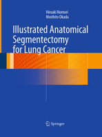 Illustrated Anatomical Segmentectomy for Lung Cancer 4431541438 Book Cover