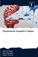 Поражения лицевого нерва 6200984751 Book Cover