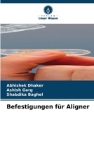 Befestigungen für Aligner (German Edition) 6630112067 Book Cover