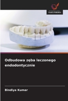 Odbudowa zeba leczonego endodontycznie (Polish Edition) 6209646417 Book Cover
