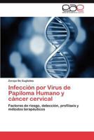Infeccion Por Virus de Papiloma Humano y Cancer Cervical 365900507X Book Cover