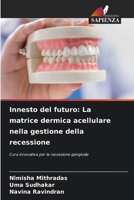 Innesto del futuro: La matrice dermica acellulare nella gestione della recessione (Italian Edition) 6209794335 Book Cover