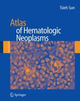 Atlas of Hematologic Neoplasms 1489988793 Book Cover