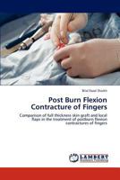 Post Burn Flexion Contracture of Fingers 3659214590 Book Cover