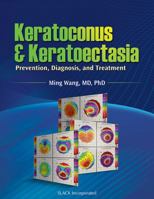 Keratoconus and Keratoectasia: Prevention, Diagnosis, and Treatment 1556429134 Book Cover