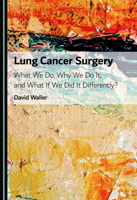Lung Cancer Surgery: What We Do, Why We Do It, and What If We Did It Differently? 1036468747 Book Cover