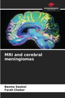 MRI and cerebral meningiomas 6208986931 Book Cover