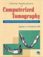 Dental Applications of Computerized Tomography: Surgical Planning for Implant Placement 0867153385 Book Cover