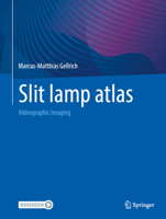 Slit Lamp Atlas: Videographic Imaging 366270272X Book Cover