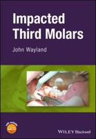 Impacted Third Molars 1119930308 Book Cover
