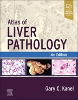 Atlas of Liver Pathology (Atlases in Diagnostic Surgical Pathology) 0323825338 Book Cover