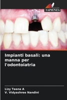 Impianti basali: una manna per l'odontoiatria (Italian Edition) 6206834697 Book Cover