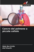 Cancro del polmone a piccole cellule (Italian Edition) 6209500412 Book Cover