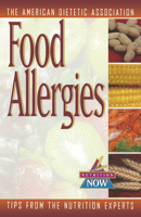 Food Allergies : Up-to-Date Tips from the World's Foremost Nutrition Experts 0471347140 Book Cover