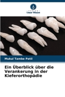 Ein Überblick über die Verankerung in der Kieferorthopädie (German Edition) 6206497402 Book Cover