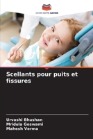 Scellants pour puits et fissures (French Edition) 6209548172 Book Cover