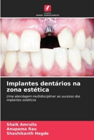 Implantes dentários na zona estética 6209128874 Book Cover