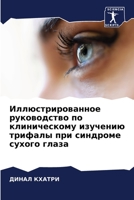 Иллюстрированное руководство по клиническому изучению трифалы при синдроме сухого глаза 6206007626 Book Cover