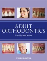 Adult Orthodontics 1405136197 Book Cover