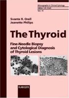 The Thyroid: Fine-Needle Biopsy and Cytological Diagnosis of Thyroid Lesions (Monographs in Clinical Cytology) 3805563833 Book Cover
