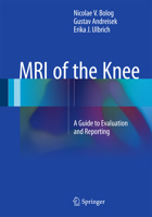 MRI of the Knee: A Guide to Evaluation and Reporting 3319081640 Book Cover