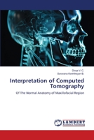 Interpretation of Computed Tomography: Of The Normal Anatomy of Maxillofacial Region 6206163075 Book Cover