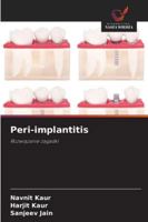 Peri-implantitis (Polish Edition) 6209335454 Book Cover